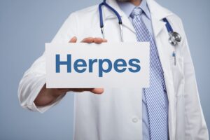 Doktor som håller upp en text där det står herpes